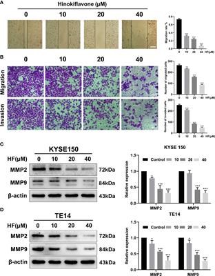 Corrigendum: Hinokiflavone Inhibits Growth of Esophageal Squamous Cancer By Inducing Apoptosis via Regulation of the PI3K/AKT/mTOR Signaling Pathway